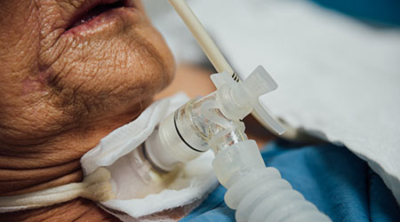 ventilator